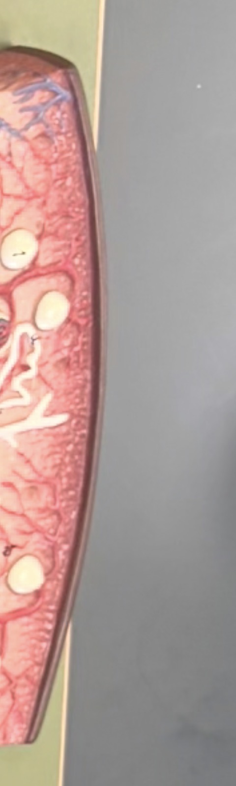 <p>also shown on edge of 2nd model</p>