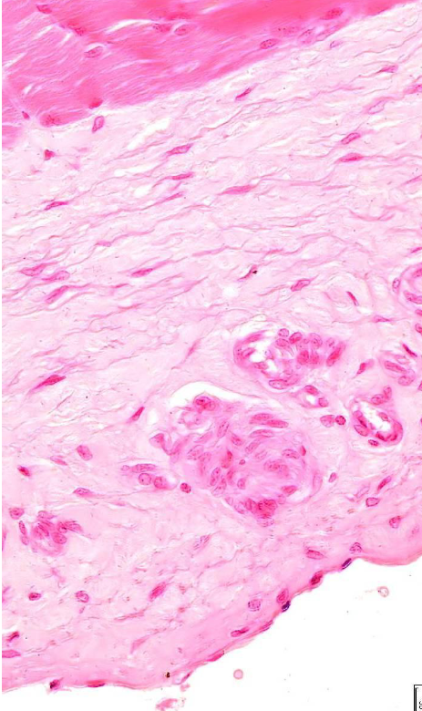 <p>soort epitheel</p>