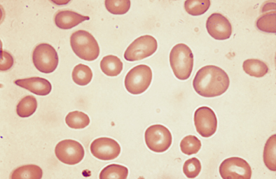 <p>What is this RBC shape?</p>