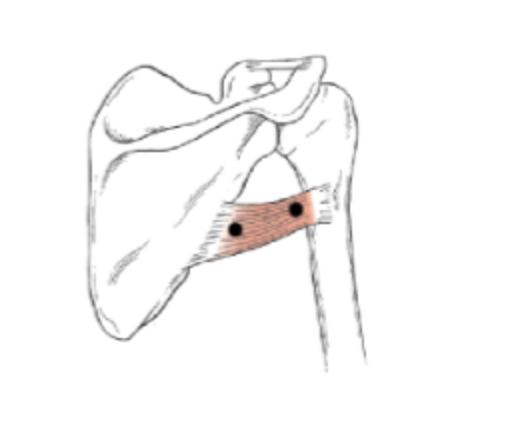 <p>What muscle is this?</p>