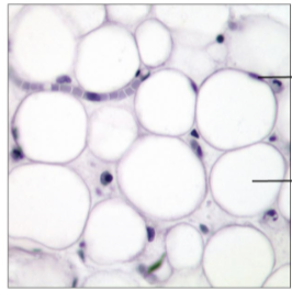 <p>what tissue type?</p>