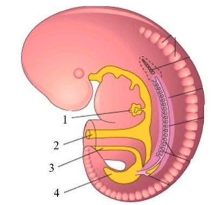 <p>Sự tồn tại của cấu trúc này sẽ có thể dẫn đến tật nang ống niệu rốn, dò ống niệu rốn, xoang ống niệu rốn ?</p><p>A. Ghi chú 2.</p><p>B. Ghi chú 3.</p><p>C. Ghi chú 4</p><p>D. Ghi chú 1.</p>