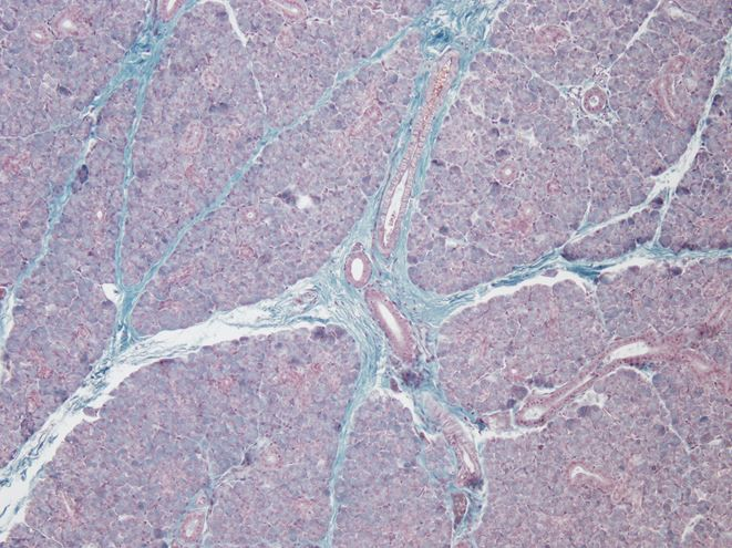 <p>Tiêu bản gì ?</p>