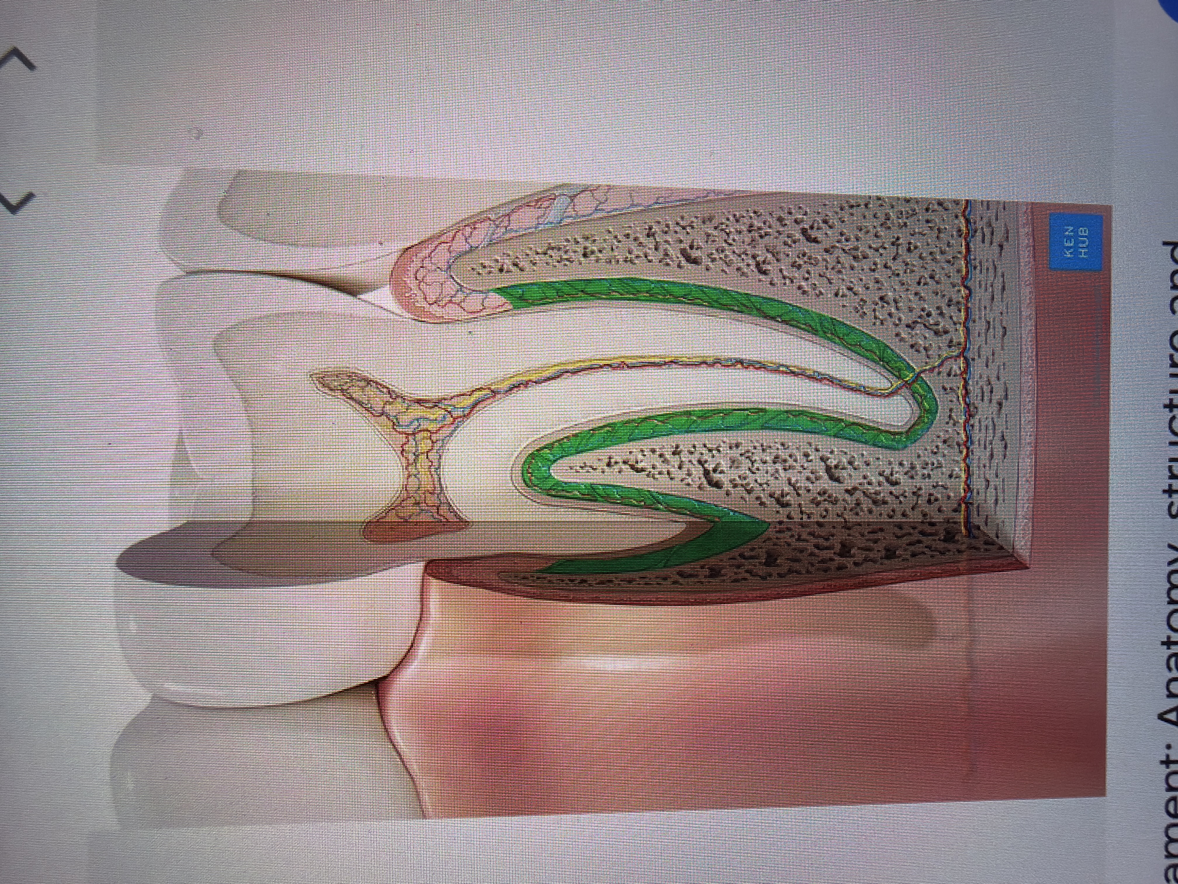 term image
