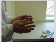 <p>Physiologic. 2 transverse axes. Sphenoid and occiput (the midline bones) will rotate opposite of each other. Fingers will point upwards, palms move medially, and fingers approximate/come together</p><p></p><p>Extra Info for Comp:</p><p>Occurs during exhalation. During extension, sphenoid will rotate backward and occiput will rotate forward. Paired bones will internally rotate. Spheno-basilar junction will move inferiorly.</p><p>AP diameter of cranium lengthens. Lateral diameter of cranium shortens.</p><p>As occiput moves forward, it will release dural strain on the sacrum and cause nutation (sacrum will rotate forwards and slightly inferiorly)</p>