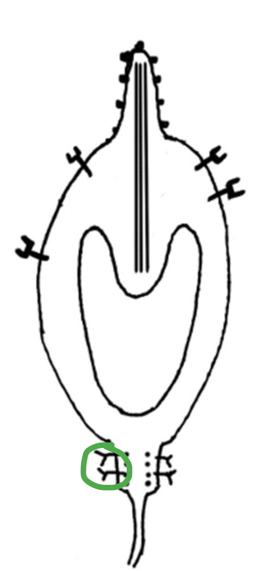 <p>What type of receptor is this?</p>