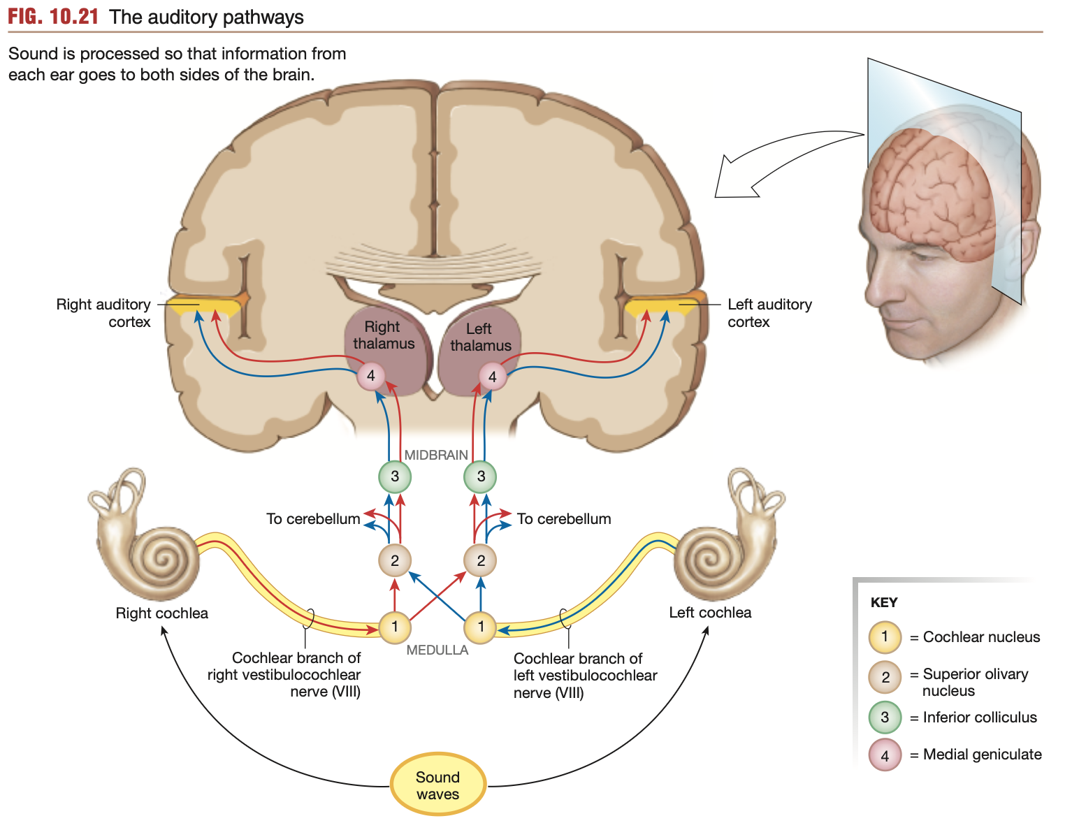 <p><strong><mark data-color="blue" style="background-color: blue; color: inherit;">Special </mark><mark data-color="purple" style="background-color: purple; color: inherit;">somatic</mark><mark data-color="blue" style="background-color: blue; color: inherit;"> afferent</mark></strong><mark data-color="blue" style="background-color: blue; color: inherit;"> nerves of the&nbsp;Vestibulo</mark><strong><u><mark data-color="blue" style="background-color: blue; color: inherit;">cochlear</mark></u><mark data-color="blue" style="background-color: blue; color: inherit;"> nerve (Cranial nerve 8)</mark></strong></p><p><strong><em><u>Where?</u></em></strong></p><ol><li><p>Action potentials propagate from hair cells</p></li><li><p>Travel along the <mark data-color="blue" style="background-color: blue; color: inherit;">cochlear branch</mark> of the vestibulo<strong><u>cochlear</u> </strong>nerve</p></li><li><p>Synapse with the <strong>cochlear nuclei</strong> within the <strong>brain stem’s medulla</strong></p></li><li><p>Information from both ears combines within the <strong>cochlear nuclei</strong></p></li><li><p>Fibres travel up the brain stem, some staying on their respective sides</p></li><li><p>Fibres reach the <strong>temporal lobe</strong>, and respect left &amp; right <strong>auditory cortices</strong> (cortexes)</p></li><li><p>Hearing is perceived</p></li><li><p>Auditory info is processed by other sections of the brain to enable <strong>interpretation</strong> &amp; <strong>integration</strong> of the image</p></li></ol><p><strong><em>Beginning:</em></strong> In the inner ear, specifically base of hair cells lining the cochlea</p><p><strong><em>Ending:</em></strong> <mark data-color="green" style="background-color: green; color: inherit;">Primary auditory cortex, temporal lobe</mark></p>