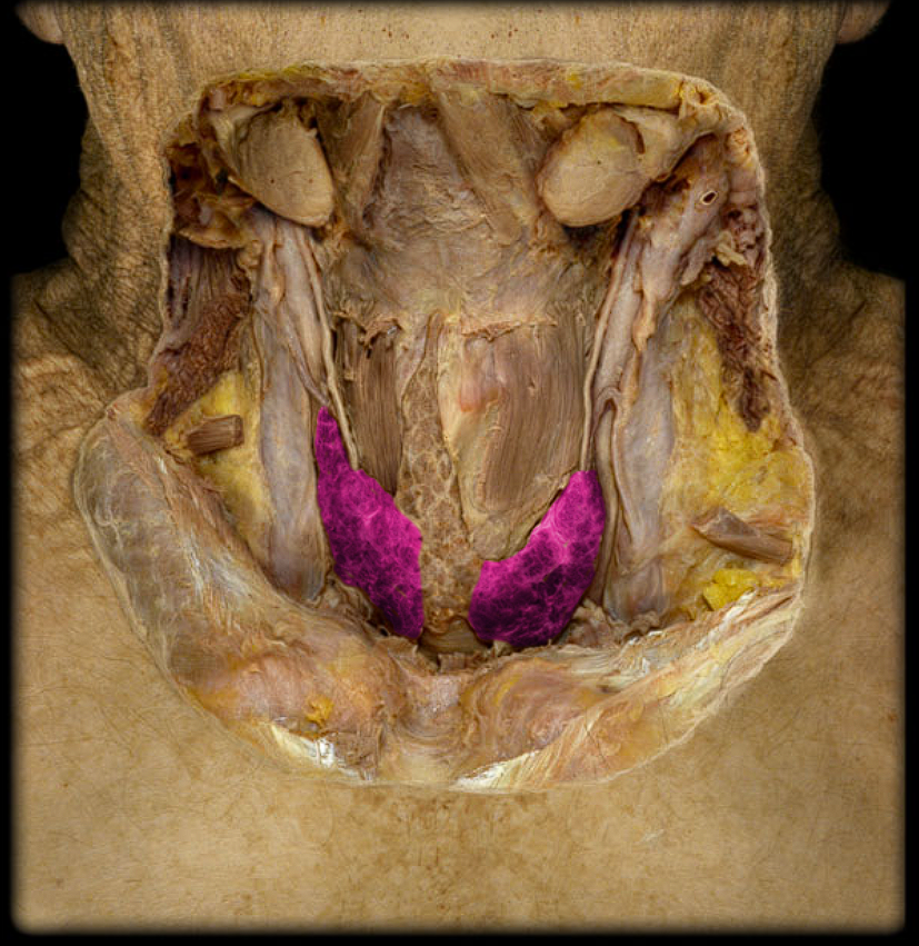 term image