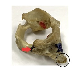 <p>what is marked? (not the arrow)</p>