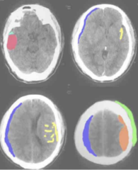 <p>label and define</p>