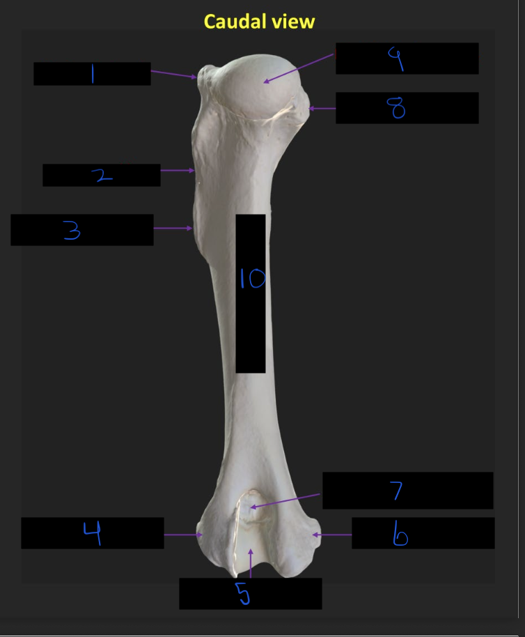 <p>Name these parts of the humerus</p>