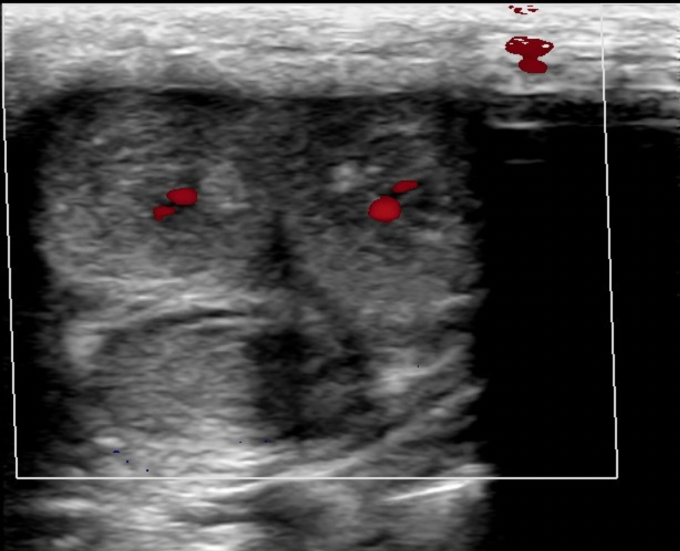<p>What blood vessels are demonstrated on the cross section of the penis?</p><p>A. cavernosal arteries</p><p class="p1">B. dorsal arteries</p><p class="p1">C. helicine arteries</p><p class="p1">D. urethral arteries</p>