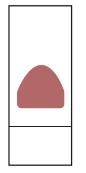 <p>what is the issue</p>