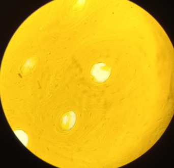<p>Bone - Schmorl Staining</p><ul><li><p>dense bone tissue contains osteons</p></li><li><p>osteons - center hole is called haversian channel that carries out blood vessels</p></li><li><p>concentric circle of collagen type 1 and hydroxyapatite</p></li><li><p>Lacunae (holes) - places where osteocytes reside </p></li><li><p>cracks of the bones (small channels “canaliculus”) - forms pathways towards center and also communicate between osteocytes</p></li></ul><p></p>