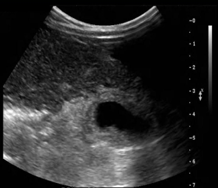 <p>Identify this image. </p>