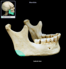 <p>What landmark of the mandible is this?</p>