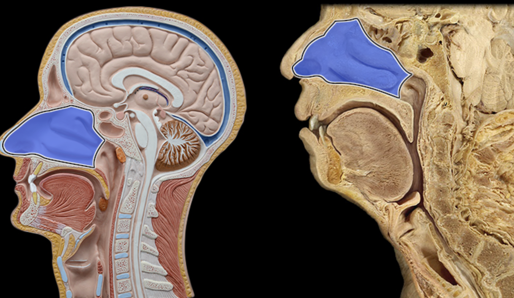 <p>Nasal cavity</p>