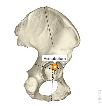 <p>where the allium, ishium, and pubis meet </p><p>form head of socket for femur </p>