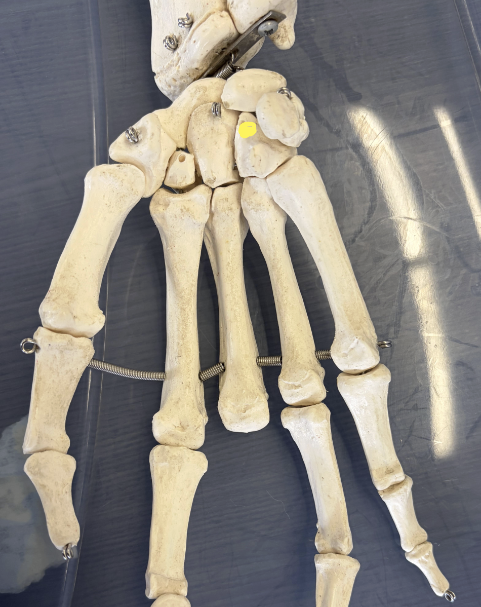 <p>What structure is this?</p><p>What nerve runs nearby?</p>