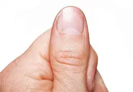 <p>(thumb)</p>