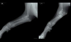 <p>Which of these joints is normal?</p>