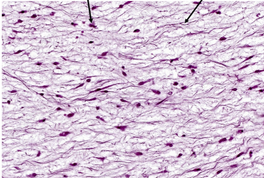 <p>Slide 16</p>