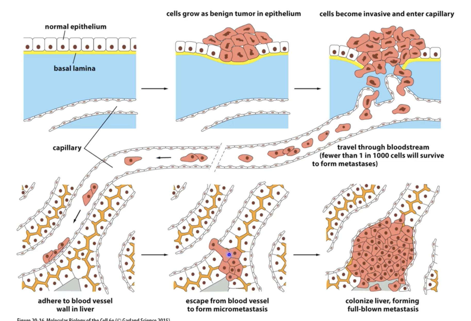 <p>Neoplasm is a fancy word for tumour!</p>
