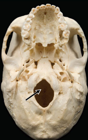 <p>Foramen</p>