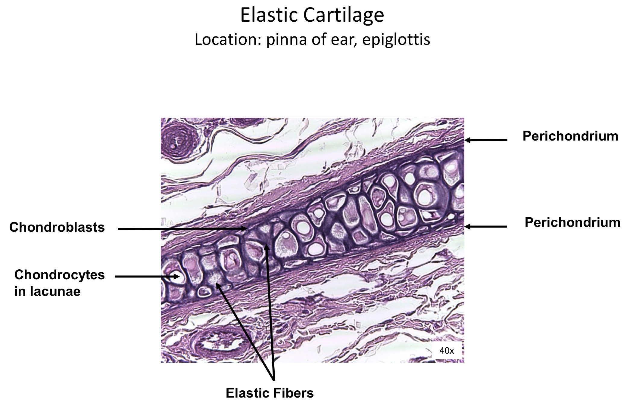 <ol><li><p>Chondroblasts </p></li><li><p>Chondrocytes in lacunae</p></li><li><p>Elastic fibers </p></li><li><p>Perichondrium</p></li></ol><p></p>