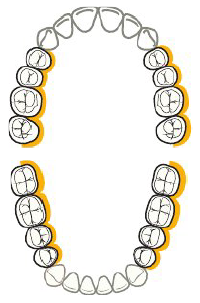 <ul><li><p>Posterior aspects facing towards clinician in yellow</p></li><li><p><strong>Clock position:</strong> 3 o’clock </p></li></ul><p></p>