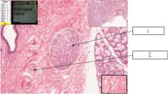 <p>What is the structure at 2</p>
