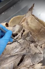 <p>Name the muscle</p><p>- most deep layer</p><p>- most lateral cervicis of spinalis and semispinalis</p>