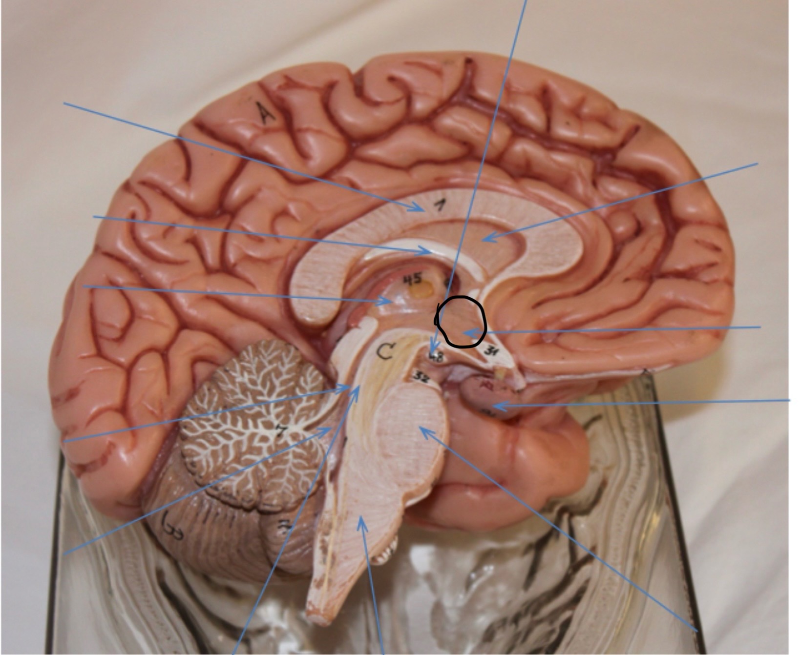 <p>Identify the circled area?</p>