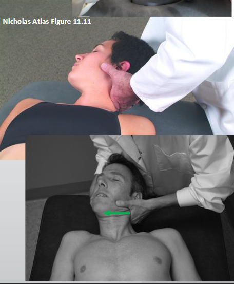 <ul><li><p>contact articular pillar w/ right 2nd MCP, rest thumb on bony facial surface</p><ul><li><p>stand on side of rotational restriction</p></li></ul></li></ul><ul><li><p>ant. translate pillar → flex until segment → SB (to barrier) + rotate (to ease)</p></li><li><p>take up slack as pt. exhales → translatory thrust to barrier</p></li></ul><p></p>