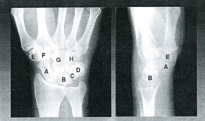 <p>C</p>