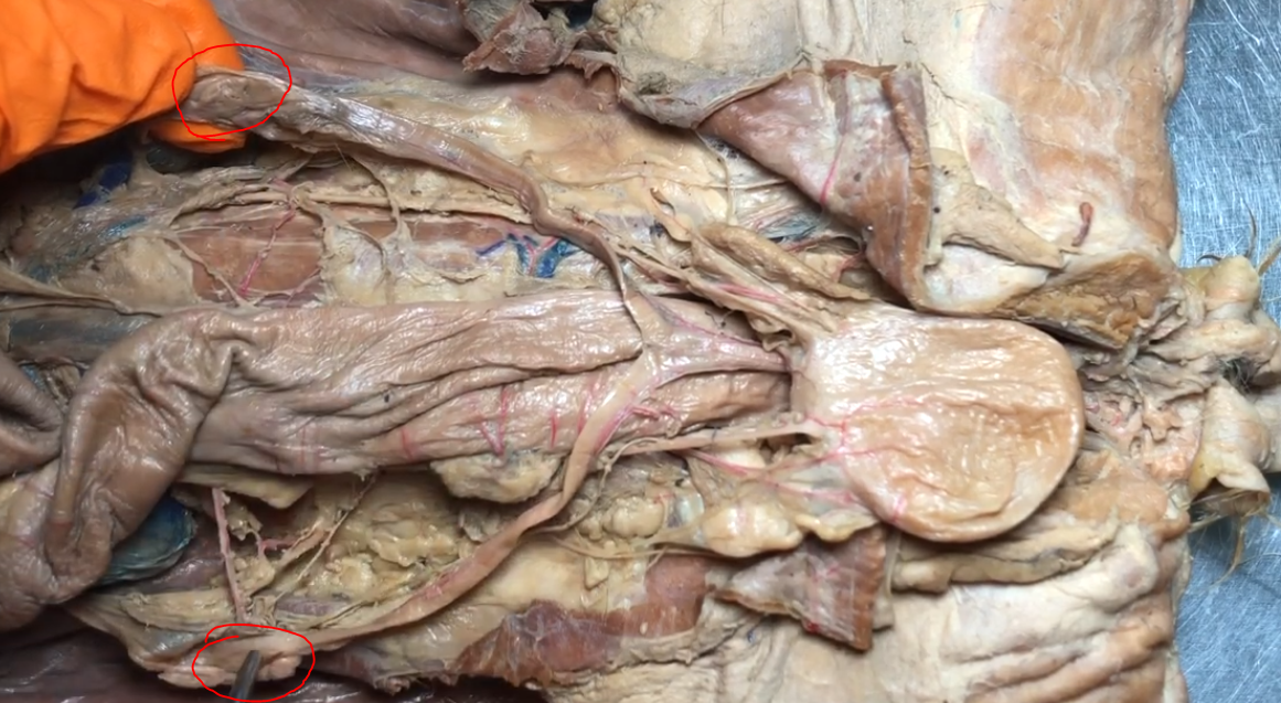 <p>What structure is this?</p>