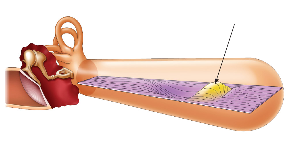 <p><span>According to the image, the sound that is being produced is a <strong>___ </strong>frequency sound, because the greatest displacement of the basilar membrane is at the <strong>___</strong></span></p>
