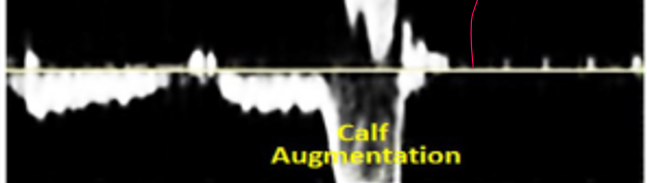 <p>what does this show</p>