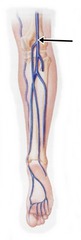 <p>Posterior</p>