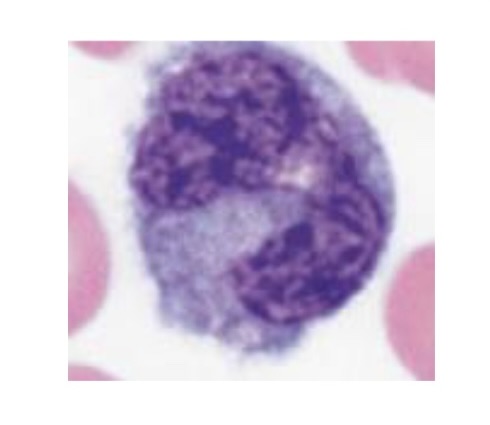 <p>What WBC is this </p>
