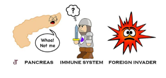 <p>insulin producing pancreatic beta cells are progressively destroyed by an autoimmune process. this is insufficient productions</p>