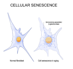<p>What is cell aging, by definition?</p>
