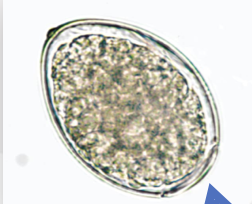 <p>What type of egg is this?</p>