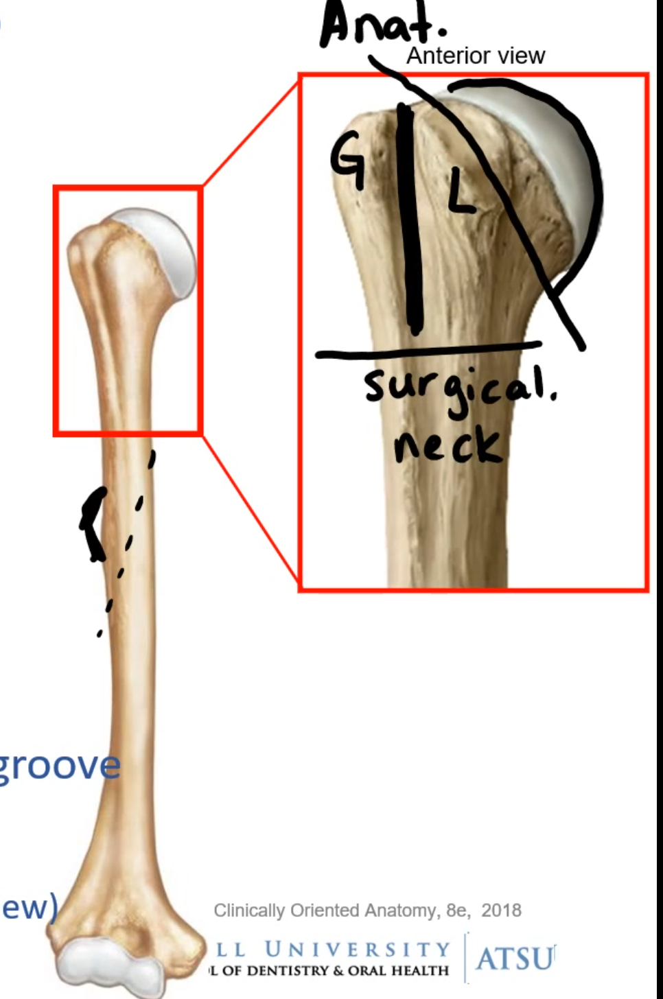 <p>Landmarks: </p><ul><li><p>Humeral head </p></li><li><p>Neck </p><ul><li><p>Anatomical </p></li><li><p>Surgical </p></li></ul></li><li><p>Greater tubercle </p></li><li><p>Lesser tubercle </p></li><li><p>Intertubercular sulcus / Bicipital groove </p></li><li><p>Deltoid tuberosity </p></li><li><p>Radial/Spiral groove (posterior view)</p></li></ul><p></p>