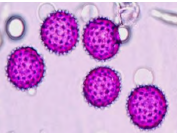 <p>type of pollen?</p>
