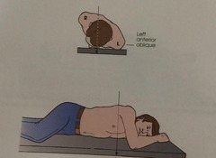 <p>refers to an angled position; positions of the thorax, abdomen, or pelvis are described by the body part closest to the IR or the body part from which the CR exits; NOT 90 degrees or perpendicular</p>