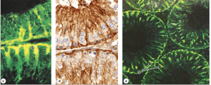 <p>What cells are immunolabeled?</p>