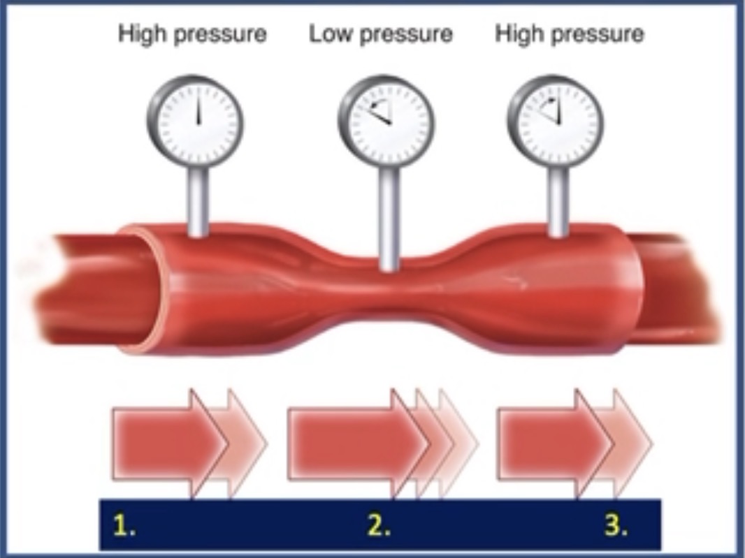 <p>Based on Bernoulli’s principle where would velocity be the highest</p>