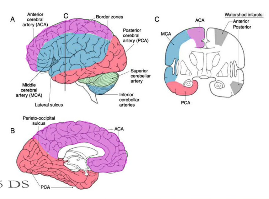<p>NOTE: should watch recording when he was talking about watershed infarcts, b/c information spoken wasn’t on the slide</p>