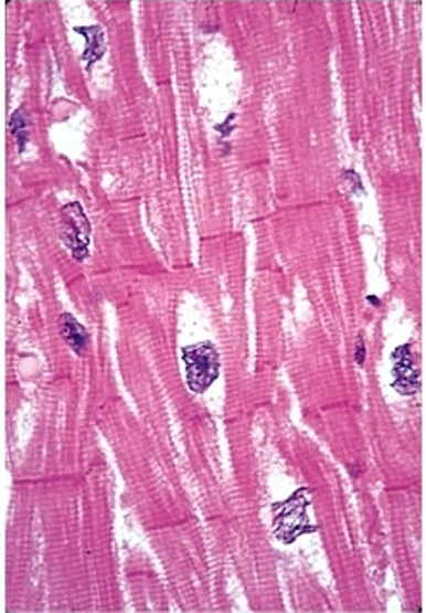 <p>shape of fibers</p><ul><li><p><span>short, cylindrical, and branched cells (often X or Y-shaped) that connect end-to-end via specialized junctions called intercalated discs.</span></p></li></ul><p>nuclei</p><ul><li><p> <mark data-color="rgba(0, 0, 0, 0)" style="background-color: rgba(0, 0, 0, 0); color: inherit;">Each cell typically contains one or two centrally located, oval-shaped nuclei</mark></p></li></ul><p></p>